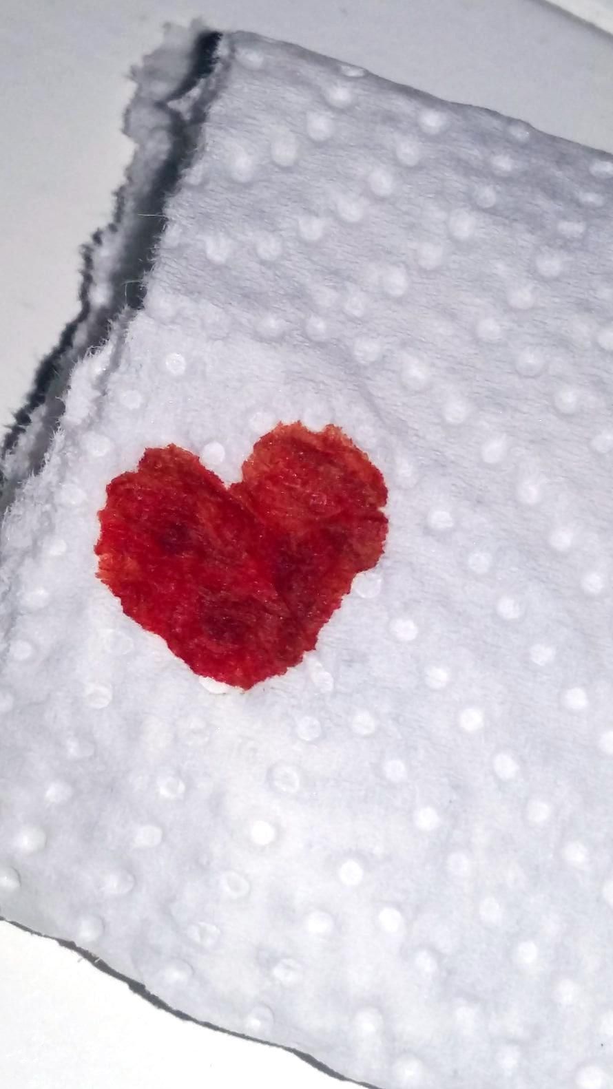 Annan akupunktiota, ja joskus voi tulla pisara verta. Tällä kertaa kohde oli rakas aviomieheni. Rakkaudella piikitetty