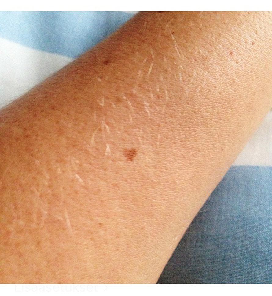 Vasemmassa kädessäni kulkee sydän aina mukana: ranteen yläpuolella oleva luomi. Maikki73