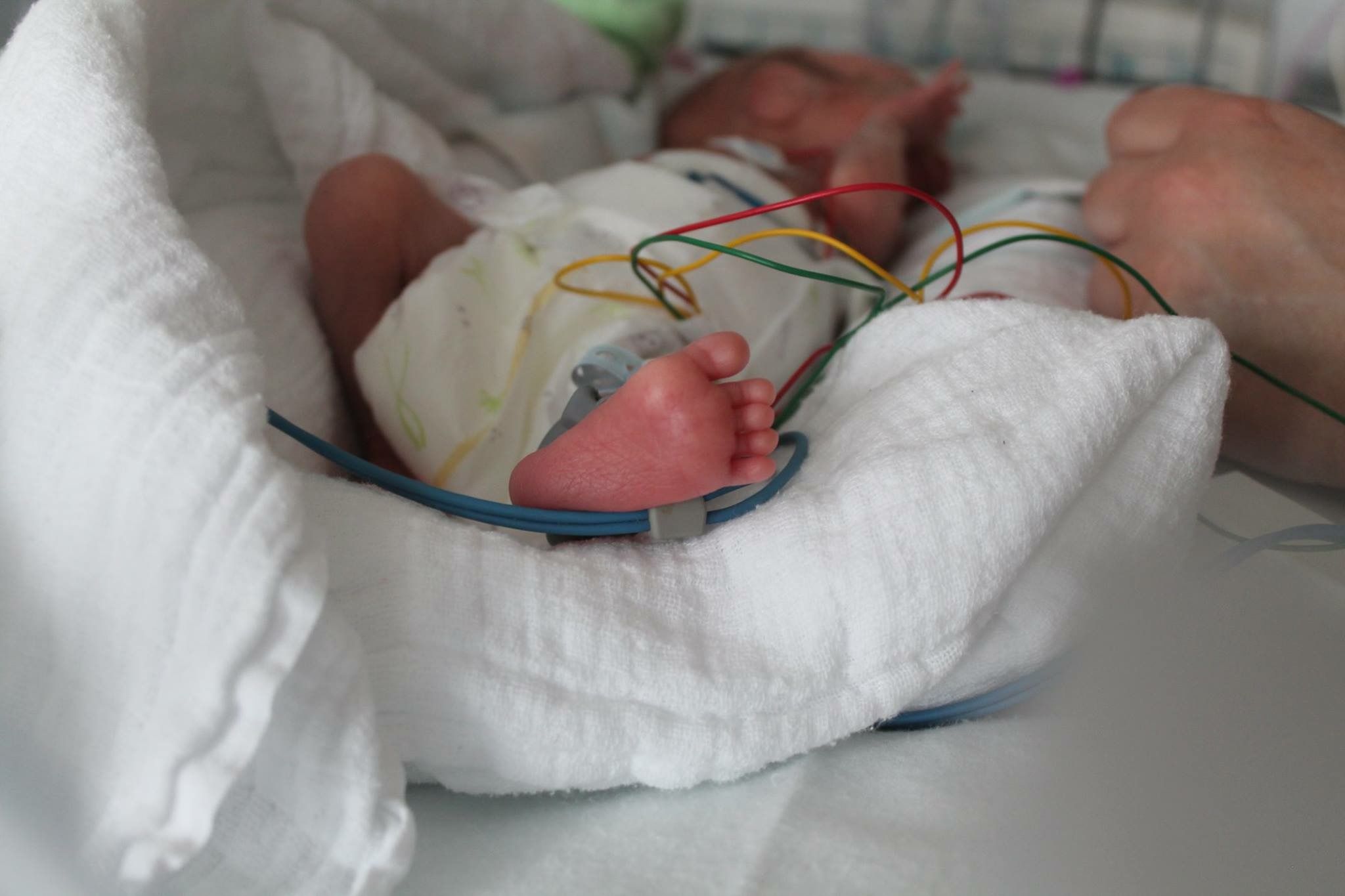 Tuomas vietiin suoraan syntymän jälkeen lasten teho-osastolle. 